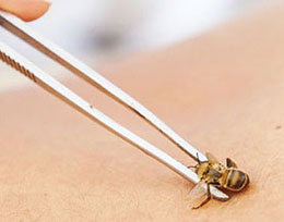 PROCEDURES OF APITHERAPY